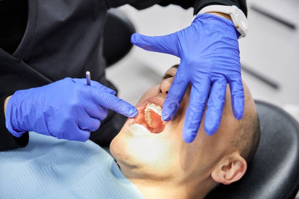 Best Emergency Dentist for Lost Fillings or Crowns in North Ridgeville, OH