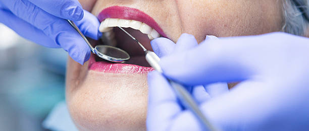 Best Emergency Dentist for Knocked-Out Tooth in North Ridgeville, OH